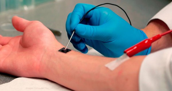 Nanochip capaz de curar heridas y órganos